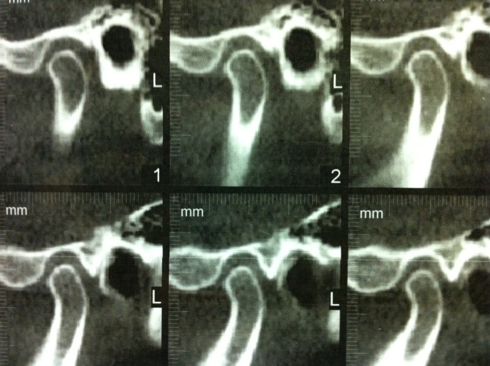 berrytmjxrayphoto My Hills Dentist