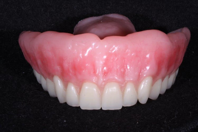 Get your dentures like these at My Hills Dentist in Sydney