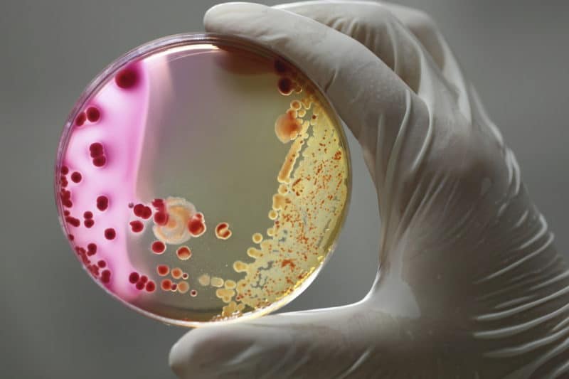 Scientist holding up a petrie dish of bacteria