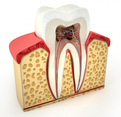 A photo of the anatomy of a tooth, and what happens with a root canal, find out more at My Hills Dentist in Sydney