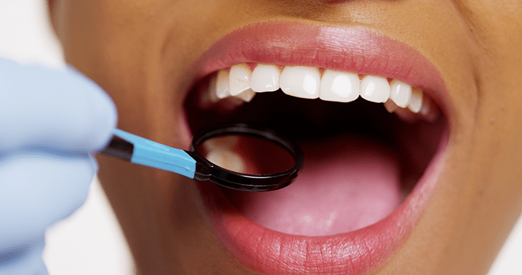 Are Your Teeth Too Short? | Baulkham Hills Dentist