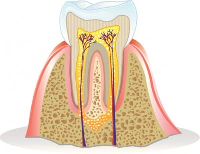 Sydney root canal therapy