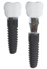 Dental implant models